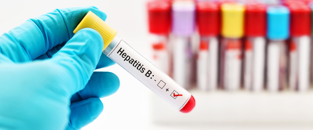 Què és lhepatitis B? Quins són els símptomes i mètodes de tractament?